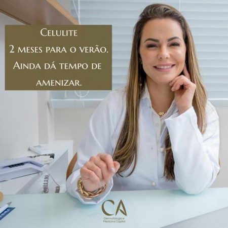 Celulite-Dra.-Camilla-Amorim